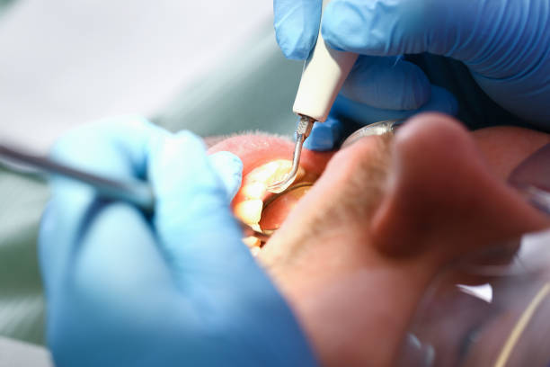 Best Emergency Broken Tooth Repair in Five Forks, SC