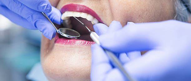 Best Emergency Tooth Extraction in Five Forks, SC